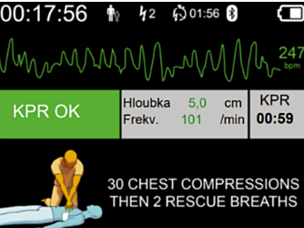 DefiSign Pocket Plus - Ecrã ECG  - 11527